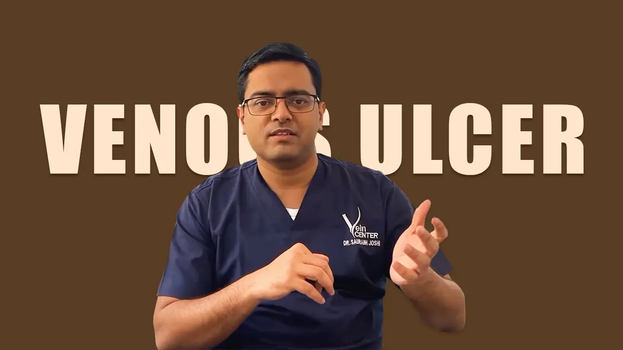 Dr. Saurabh Joshi Talks About Venous Ulcer