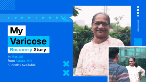 My Varicose Veins Story - How I got my smile back -Early relief, better results-min