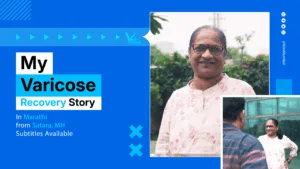 My Varicose Veins Story - How I got my smile back -Early relief, better results-min