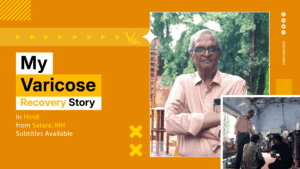 My Varicose Veins Story: Fast Recovery and Excellent Results with VenaSeal Treatment