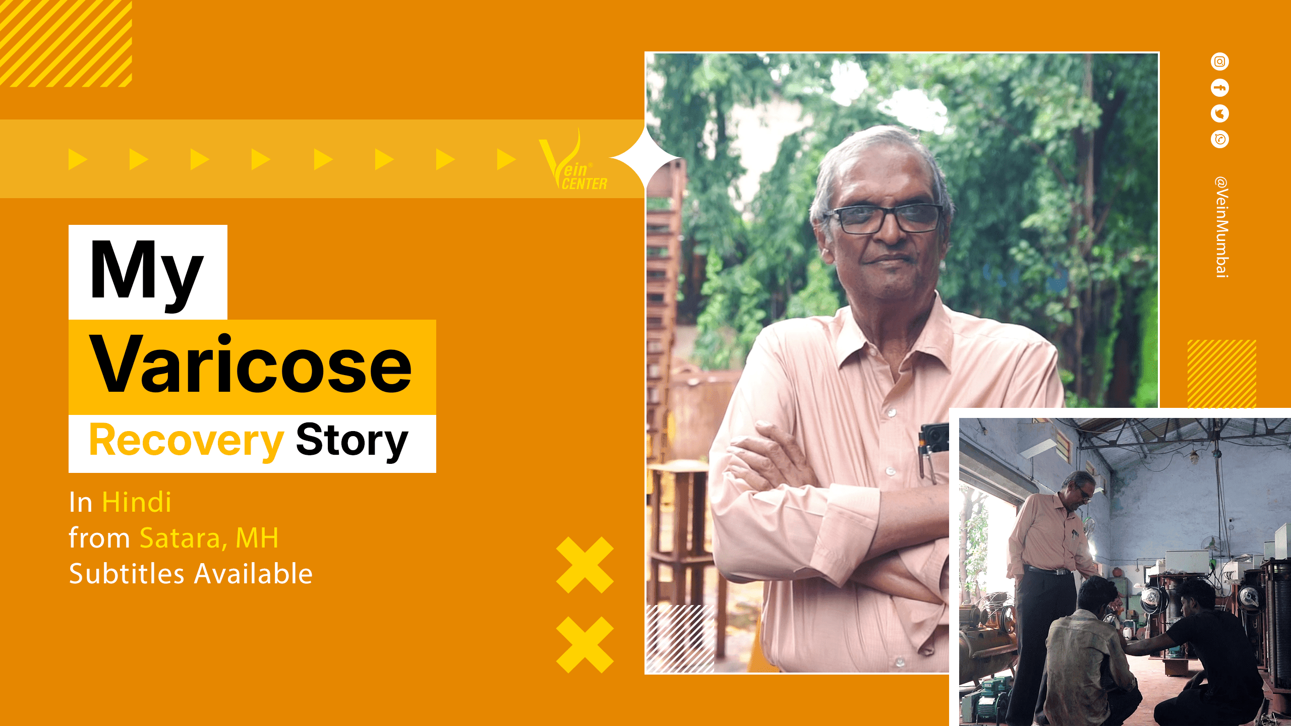 My Varicose Veins Story: Fast Recovery and Excellent Results with VenaSeal Treatment