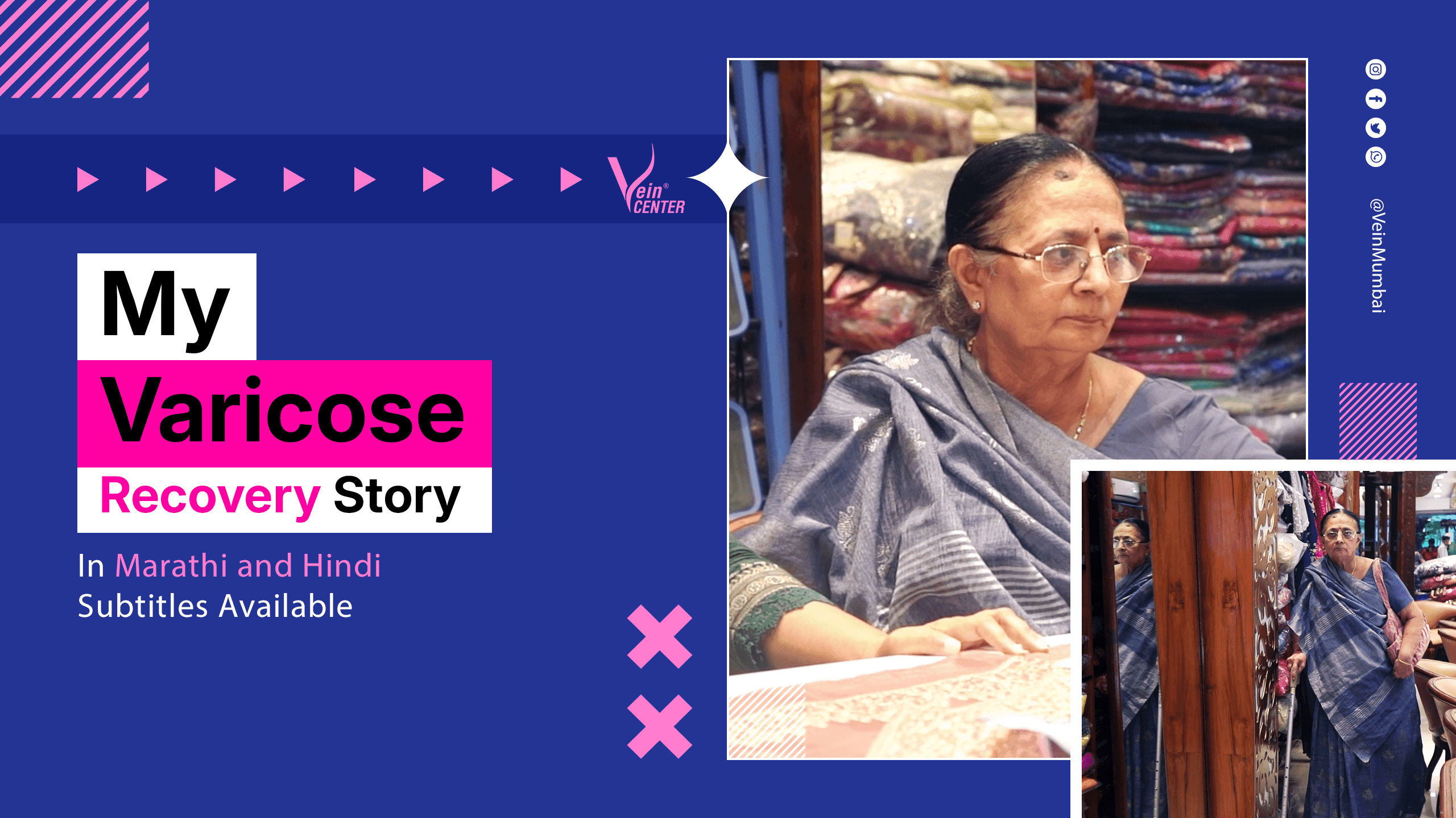 Varicose Veins Journey: From Painful Agony to Joyful Shopping in Just 6 Months