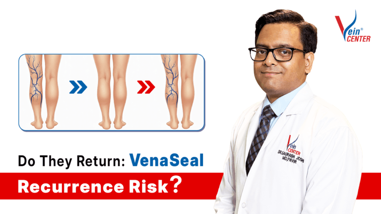 Do Varicose Veins Come Back After VenaSeal Treatment The Honest Truth